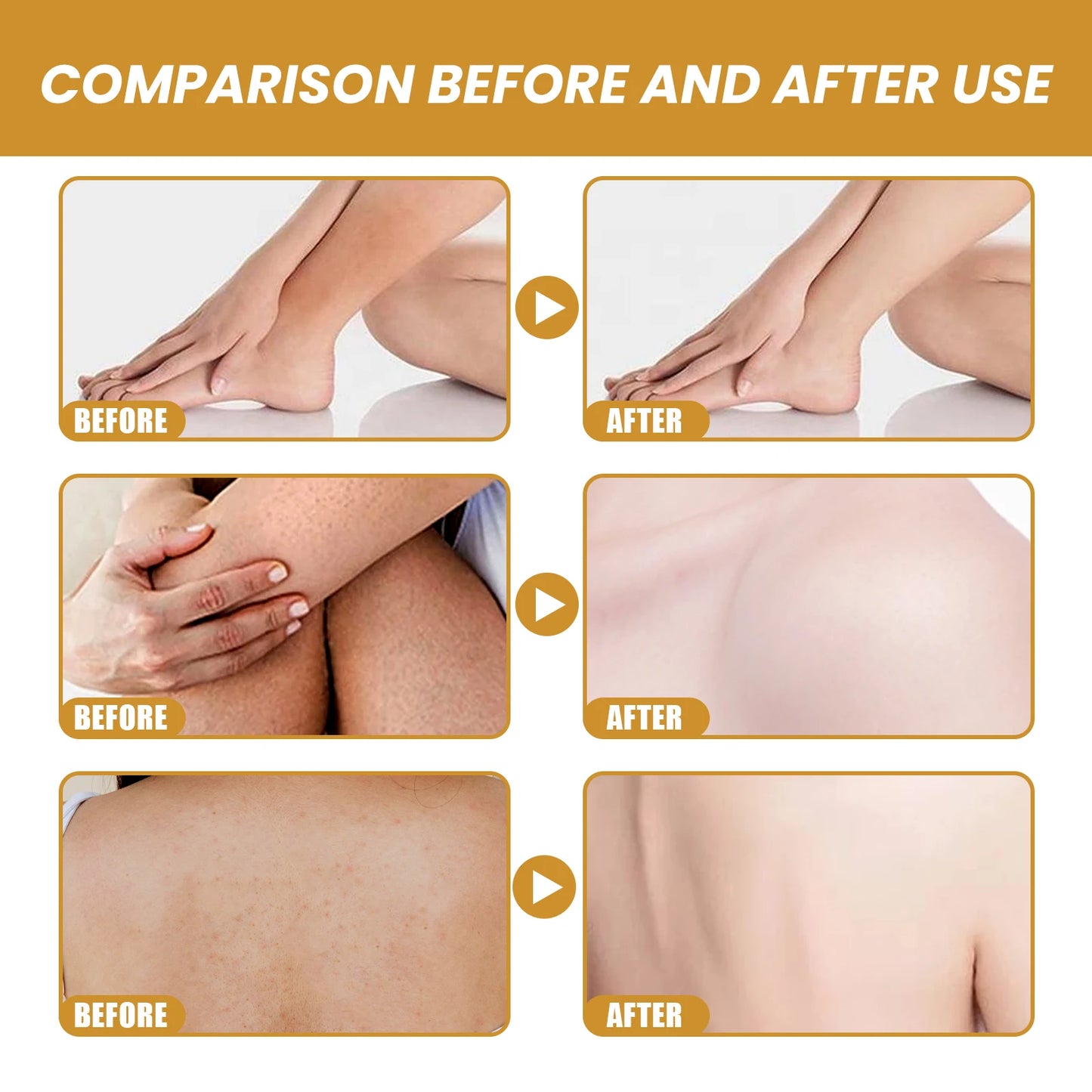 Deep Cleanses Skin Reduces Dirt